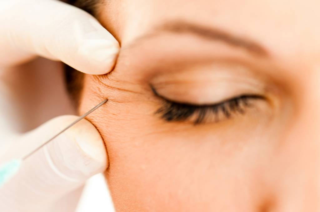 O curioso caso do botox