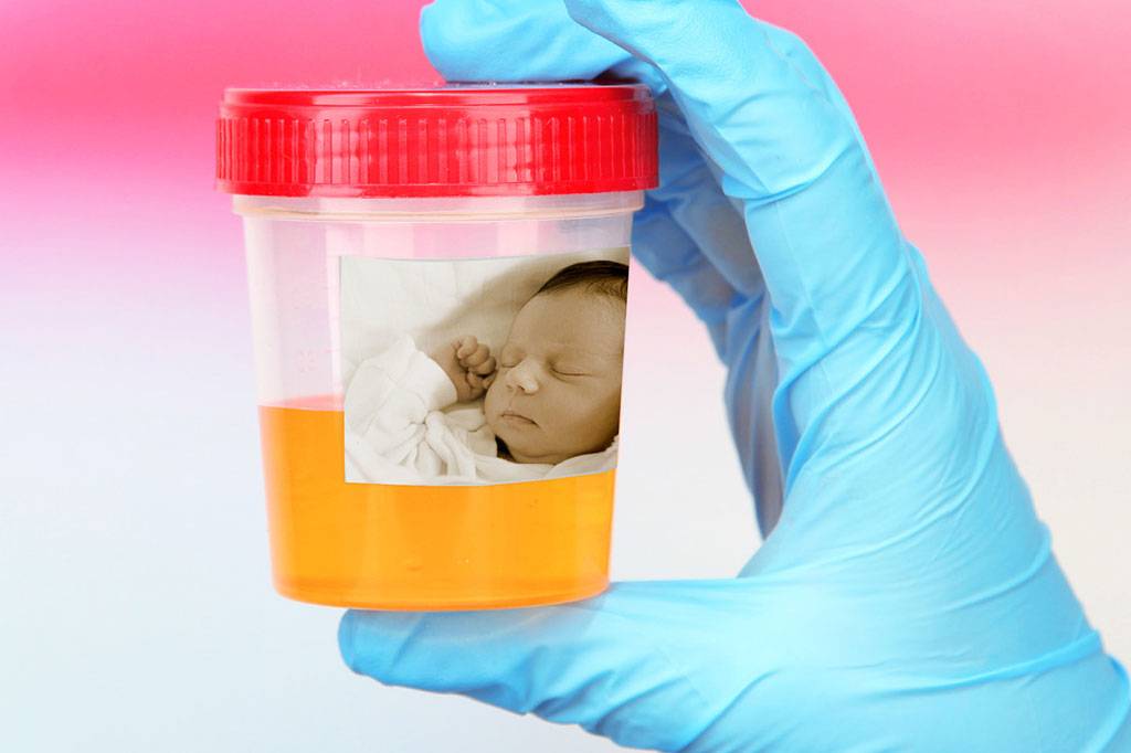 Xixi de bebês pode curar rins de adultos