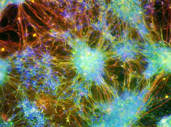 Conex&atilde;o. N&atilde;o h&aacute; nome melhor para uma foto que mostra uma rede de neur&ocirc;nios humanos conectados. A imagem &eacute; de Alexandre Teixeira Vessoni