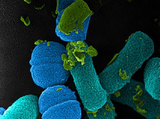 Nesta foto voc&ecirc; v&ecirc; bact&eacute;rias da mucosa oral de um rato. O autor &eacute; Ii-sei Watanabe