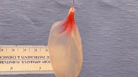 Tecido cardíaco feito de espinafre é criado por cientistas