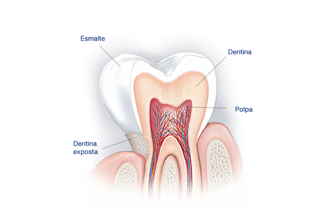 Dente Terminações Nervosas Sensodyne Dentina