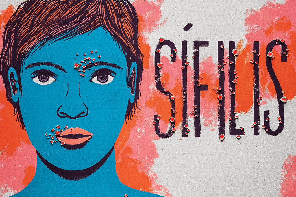 Ilustração de jovem com sífilis.