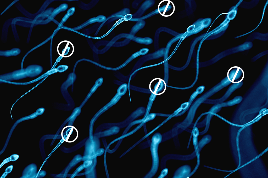 Número de espermatozoides caiu pela metade em 40 anos