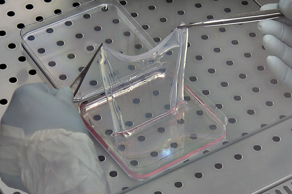 Cientistas implantam pele nova em garoto com doença genética grave