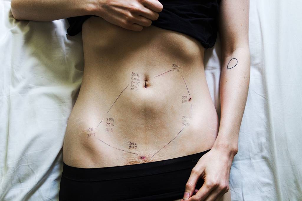 Cicatrizes do âmago: a fotógrafa que documentou a própria endometriose