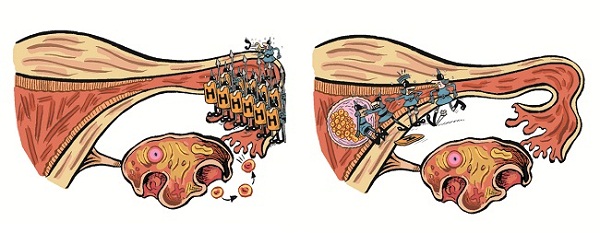 como-funciona-a-pilula-do-dia-seguintecomo-funciona-a-pilula-do-dia-seguinte