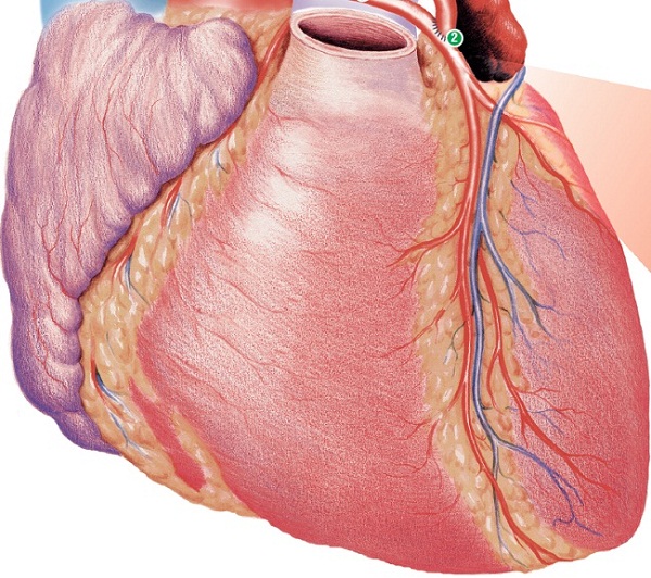 Como é feita uma ponte de safena?