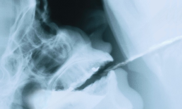 Por que o gargarejo com água morna e sal alivia a dor de garganta?