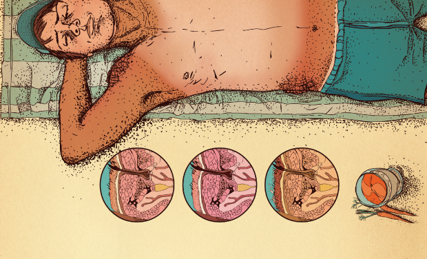 Por que perdemos o bronzeado?