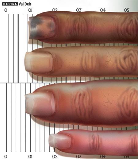 Com que velocidade crescem as unhas?