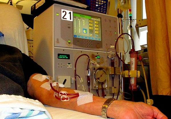 640px-Dialysis_-_arm_-_01