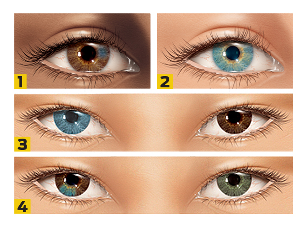 heterocromia numerada