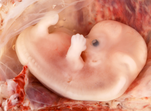 Quando começa a vida?