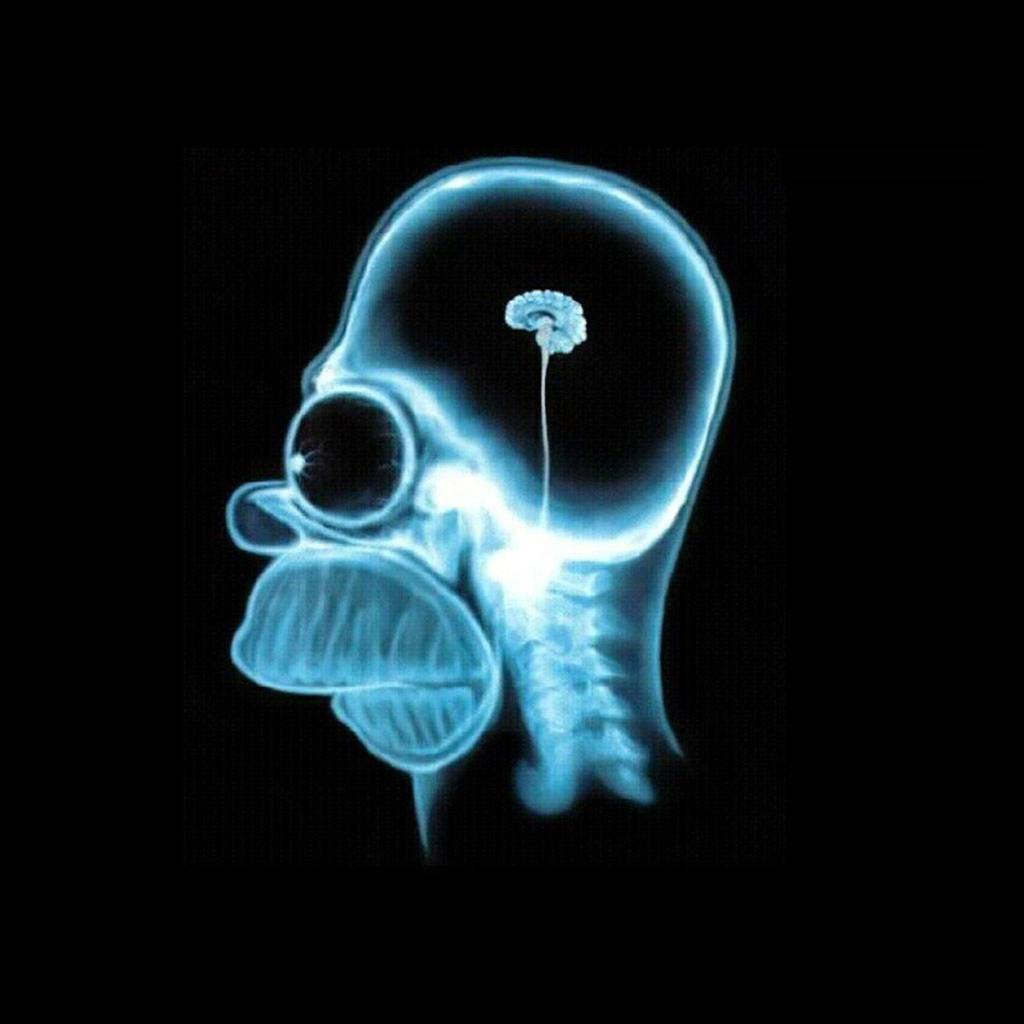 Por que o chumbo é usado como isolante em exames de raios X?