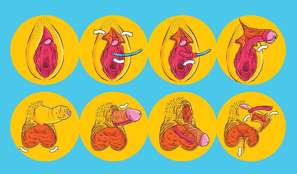 Como é uma cirurgia de redesignação sexual?