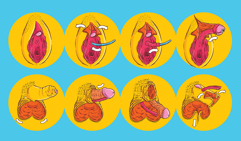 Como é uma cirurgia de redesignação sexual?