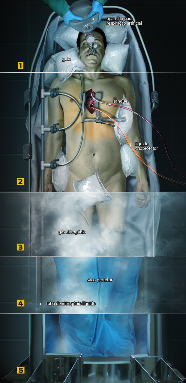 Como funciona a criogenia?