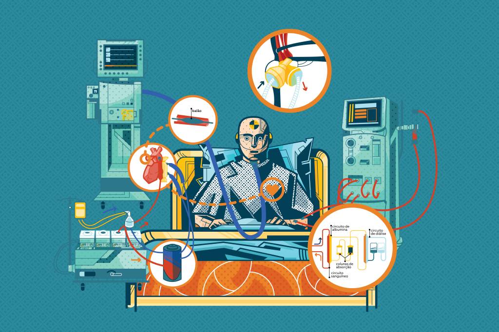 Quais máquinas são usadas quando os órgãos param de funcionar?