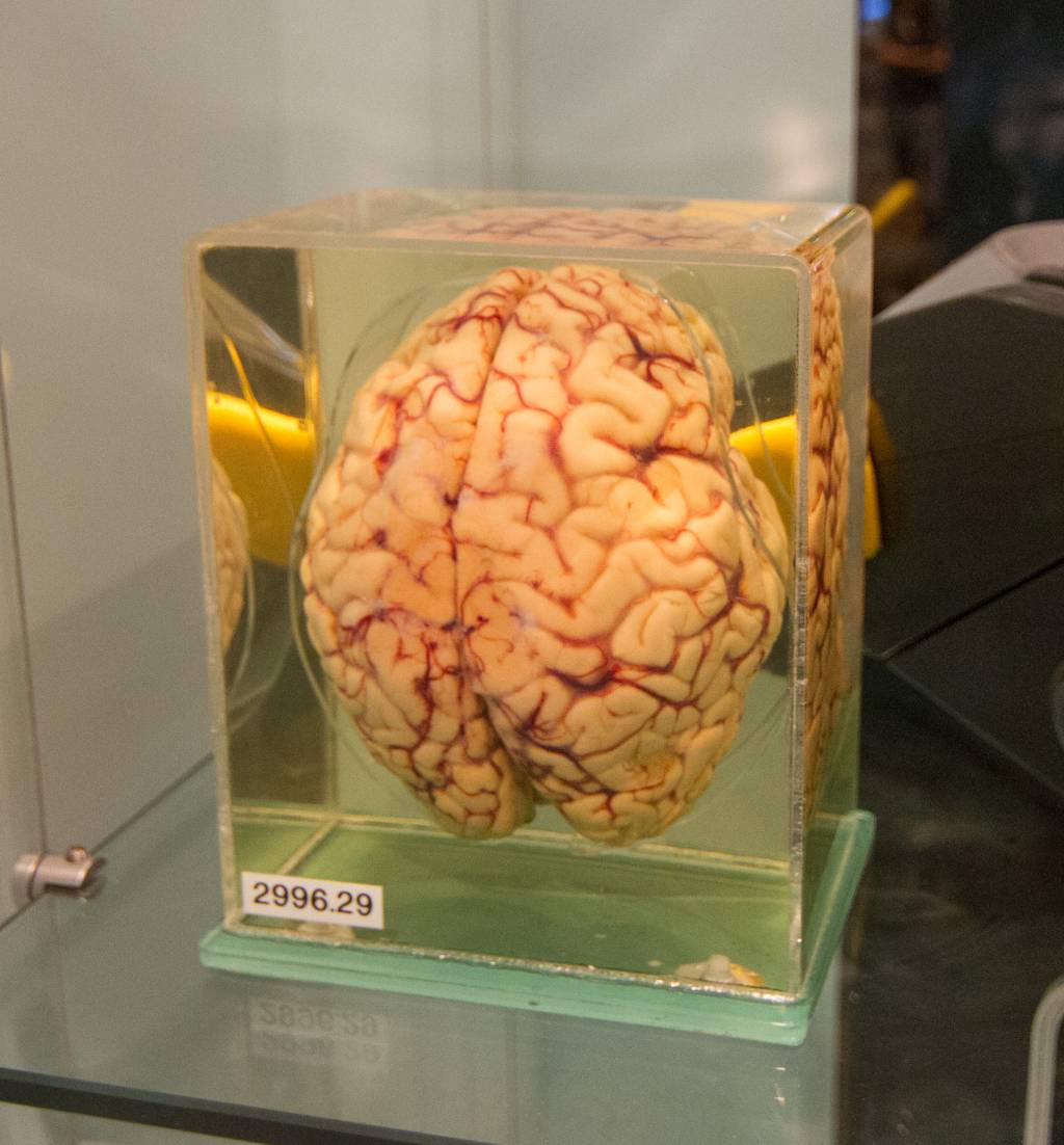 É verdade que o ser humano só usa 10% do cérebro?
