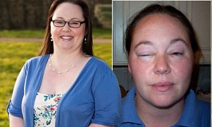 Britânica tem alergia a atividades físicas