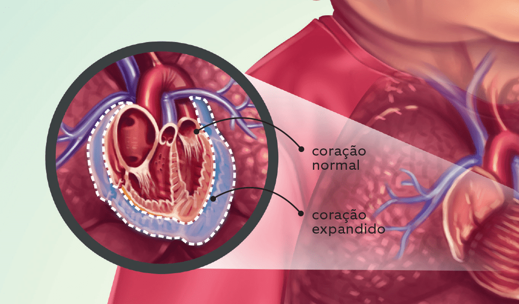 Obesidade-3