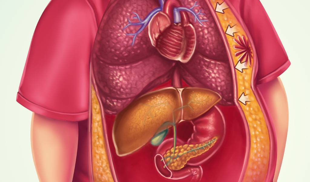 Como a obesidade infantil afeta o corpo?