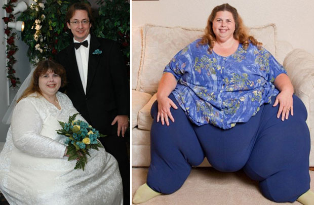 Maratona de sexo faz mulher mais gorda do mundo perder 44 kg