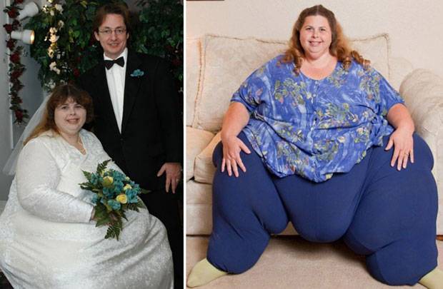 Maratona de sexo faz mulher mais gorda do mundo perder 44 kg
