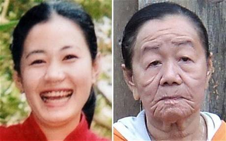 Doença misteriosa faz mulher de 26 anos aparentar mais de 70