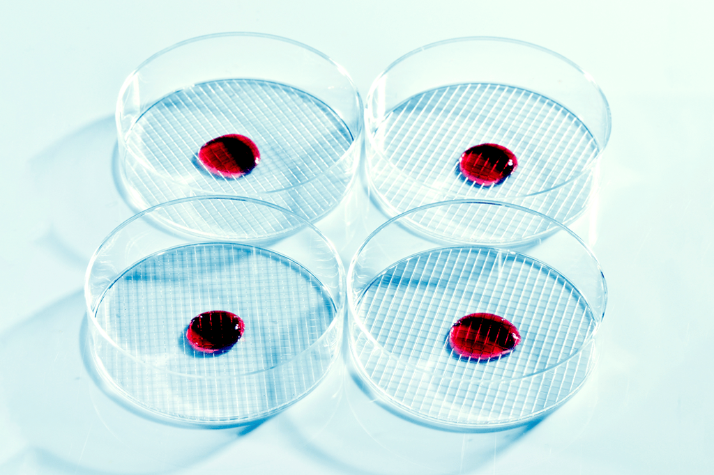 Pesquisadores descobrem como transformar sangues A e B em O