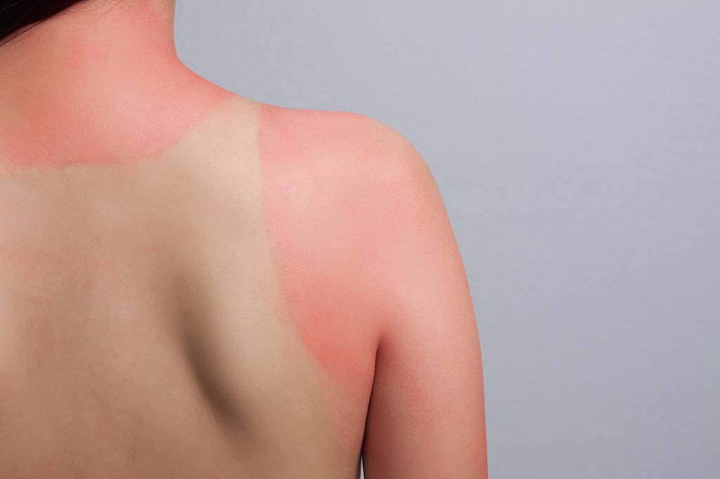 Pulserinha de papel avisa quando você passou tempo demais no Sol