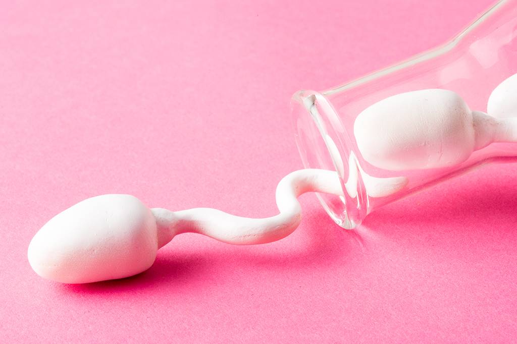Abortos espontâneos também podem ser culpa dos espermatozoides