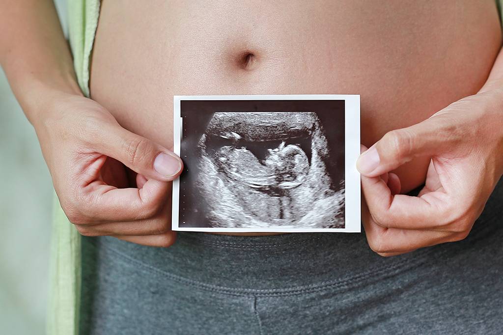 Terapia genética pode curar síndrome de Angelman em fetos