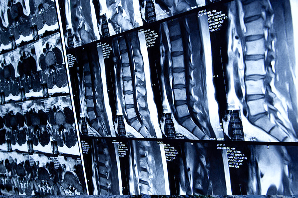Nossa medula espinhal é mais “inteligente” do que a ciência pensava