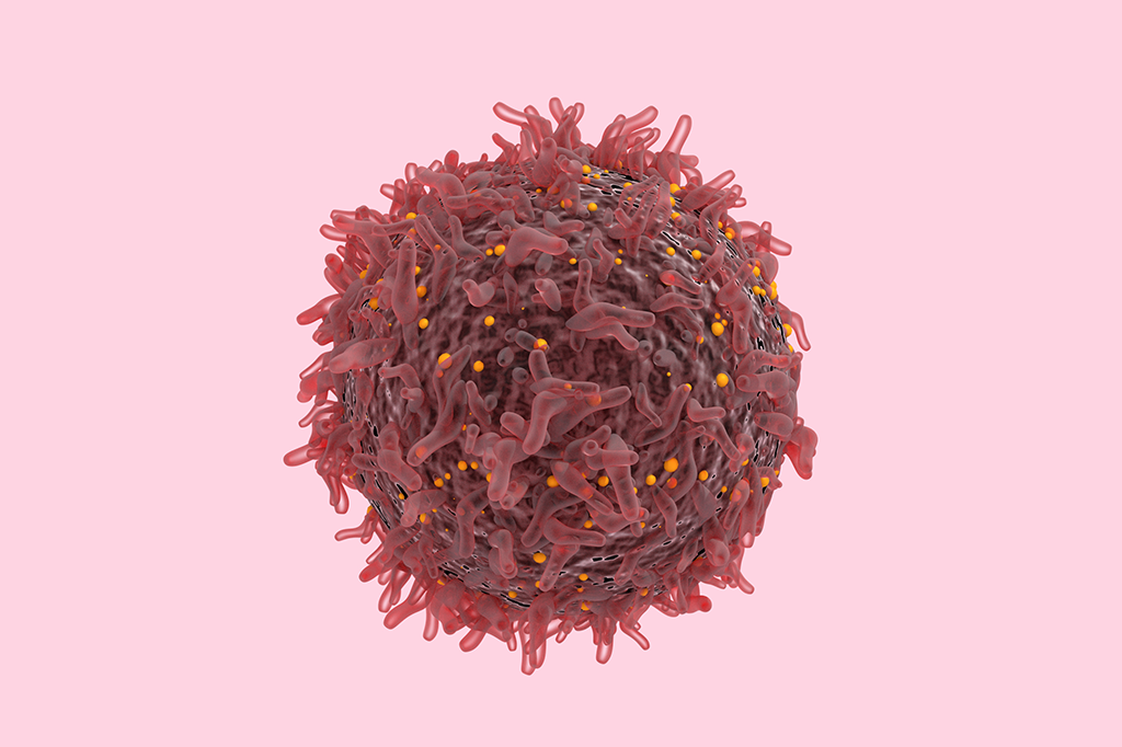 Com sistema do Google, programa detecta câncer de pulmão antes dos médicos