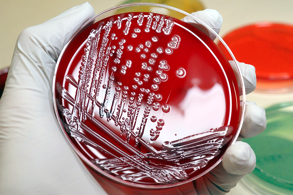 Cientistas criam 1º ser vivo com DNA 100% reescrito e sintetizado em laboratório