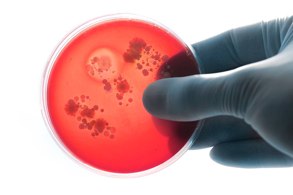 Cientistas descobrem composto que mata bactérias super-resistentes