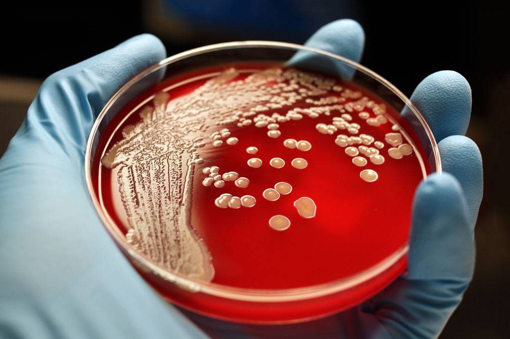 Inteligência artificial descobre novo tipo de antibiótico