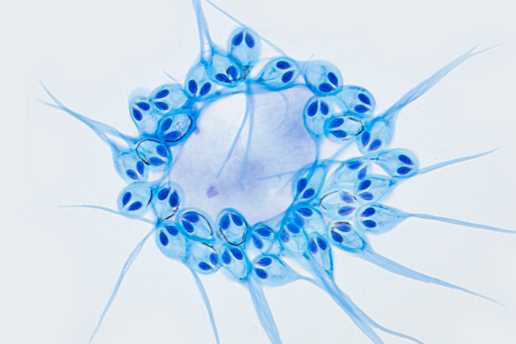 Cientistas descobrem animal capaz de sobreviver sem oxigênio