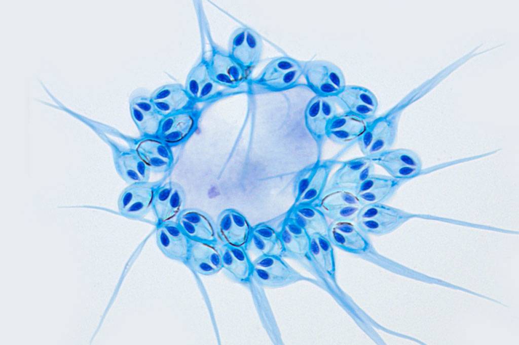 Cientistas descobrem animal capaz de sobreviver sem oxigênio