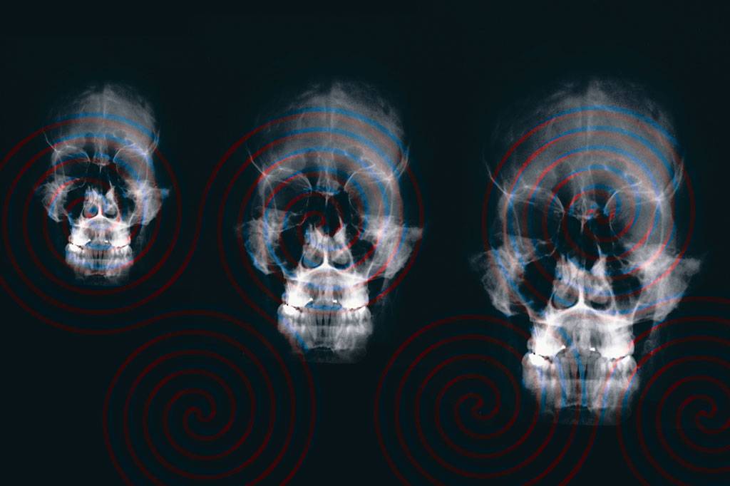 A hipnose realmente altera o funcionamento do cérebro?