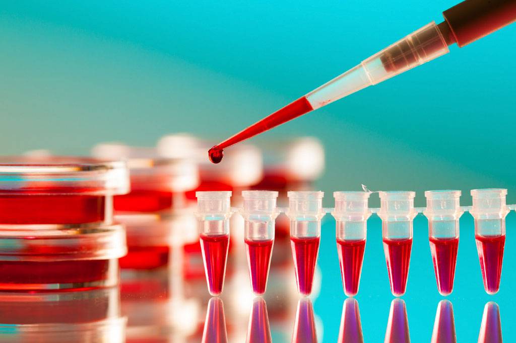 Quem é o segundo paciente curado de infecção por HIV