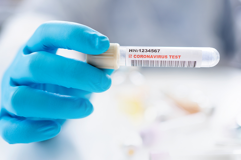 Como funciona o teste de saliva para a covid-19, que está sendo testado no Reino Unido