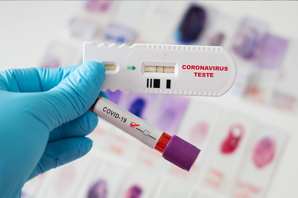 IgM ou IgG? Tire todas as dúvidas sobre anticorpos e os testes de covid-19