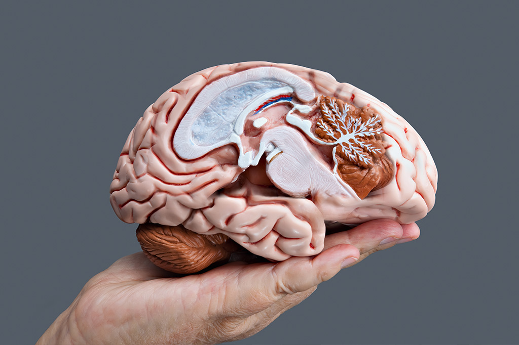 Relatório mostra 12 fatores que poderiam prevenir até 40% dos casos de demência