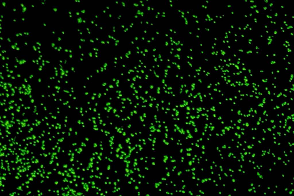 Cientistas japoneses revivem bactérias de 100 milhões de anos