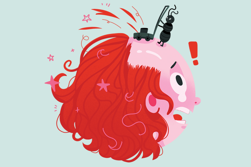 Por que a calvície segue sempre o mesmo desenho na cabeça?