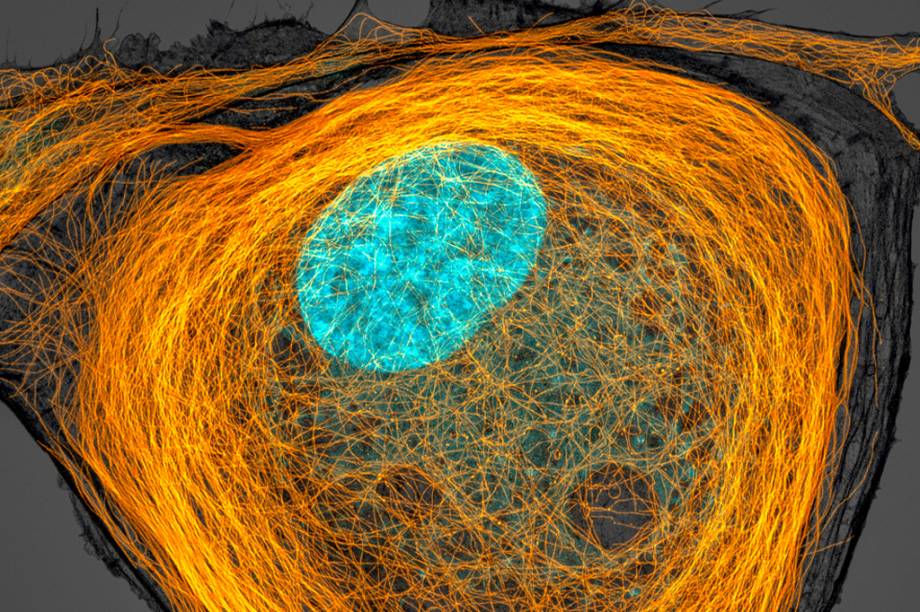 7&ordm; lugar: Em laranja, os microt&uacute;bulos &ndash; filamentos de prote&iacute;na &ndash; das paredes de uma c&eacute;lula. Em azul, o seu n&uacute;cleo.