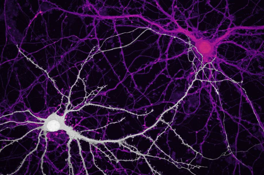 9&ordm; lugar: As conex&otilde;es entre neur&ocirc;nios do hipocampo, regi&atilde;o do c&eacute;rebro humano ligada &agrave;s emo&ccedil;&otilde;es e &agrave; mem&oacute;ria.